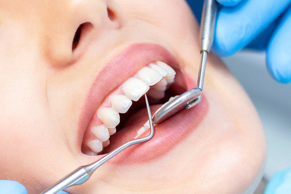 Dental İmplant Nedir