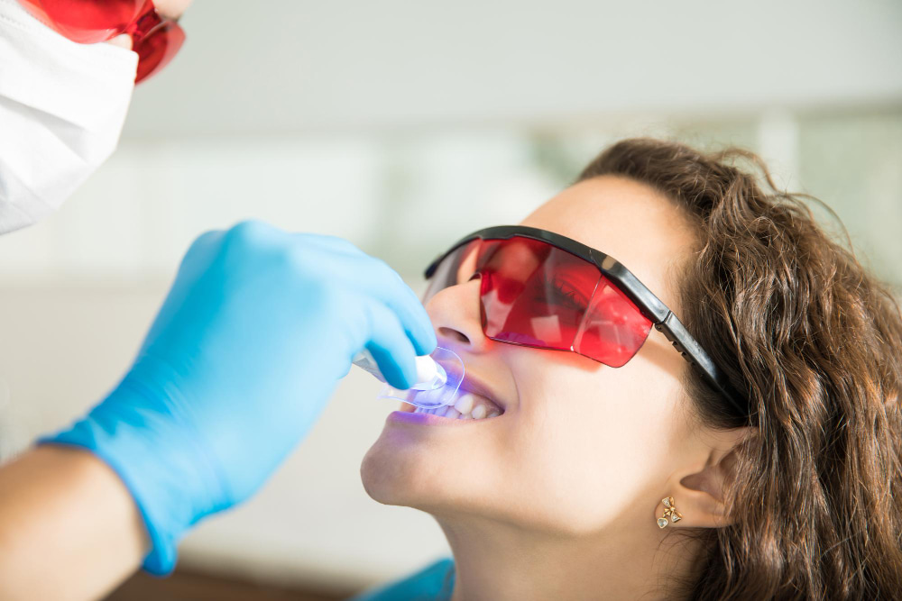 diş beyazlatma sonrası dikkat edilmesi gerekenler 5 şey