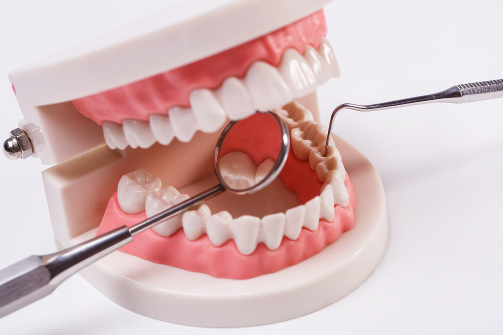 Protez Diş Nedir? Nasıl Yapılır? Çeşitleri Nelerdir?
